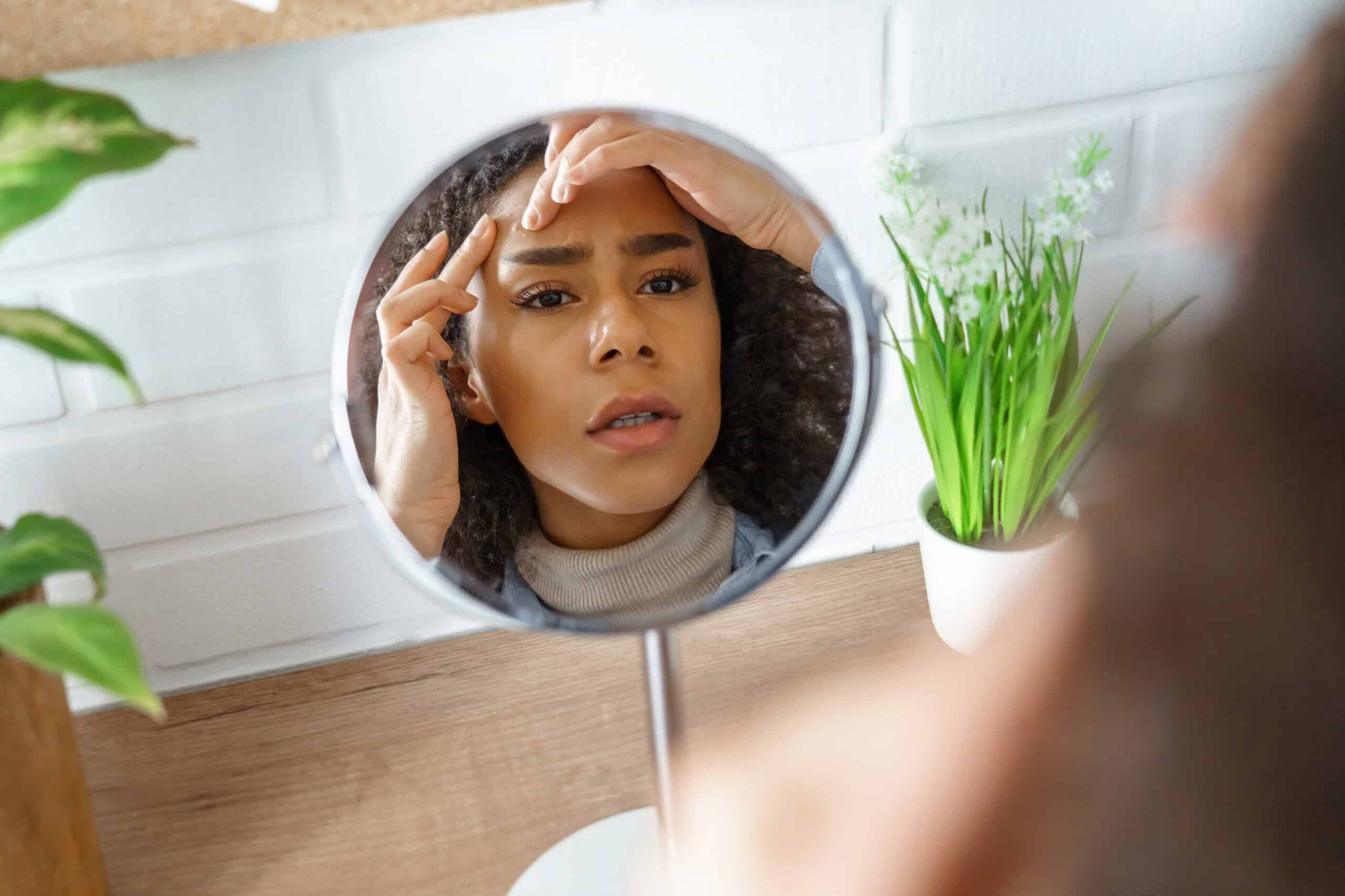 woman looking at forehead acne in mirror