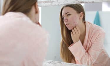 woman looking in mirror at facial acne