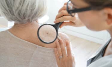 dermatologist examines woman for skin cancer